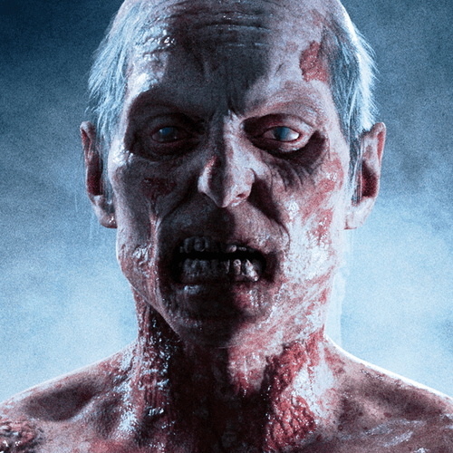 TWD Degenerative Stage 2